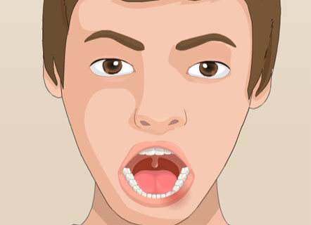 Гра Операція у роті